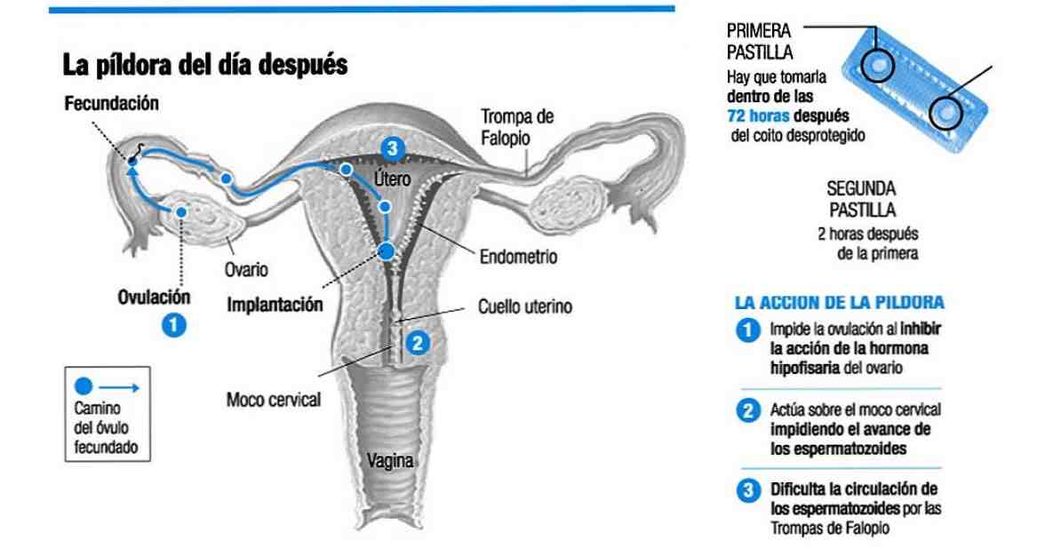 Dolor de ovarios justo después de la regla Dolor de ovarios justo después de la regla